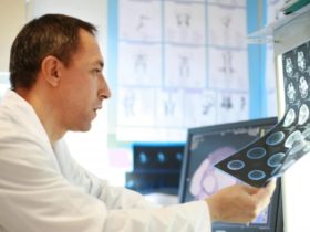 У Краматорську застосовують штучний інтелект для аналізу КТ-знімків головного мозку