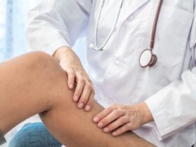 безкоштовні консультації судинних хірургів