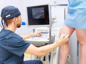 безкоштовні консультації судинних хірургів